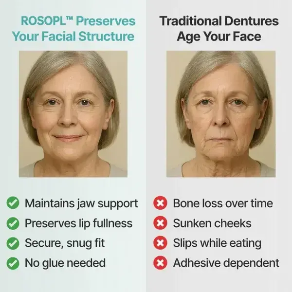 ROSOPL™ Custom-Fit Functional Dentures