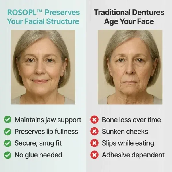ROSOPL™ Premium Full Dentures