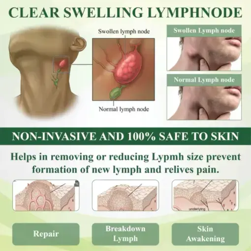 ROSOPL™ Leg Therapy Edema Cream Trust