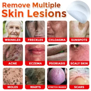 Alternative view of ROSOPL® MicroNeedle Skin Growth Removal Patch