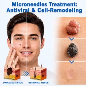 ROSOPL® 2-in-1 Microneedle & Hydrocolloid Patch