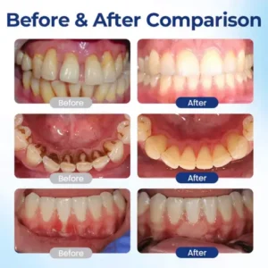 ROSOPL™ BeeTakt Oral Repair Solution