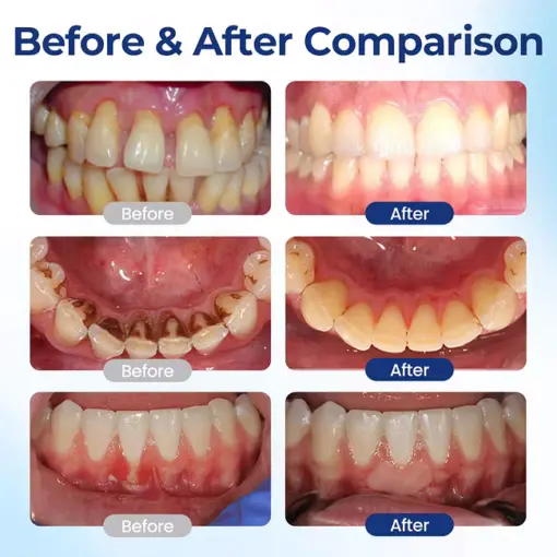 ROSOPL™ BeeTakt Oral Repair Solution